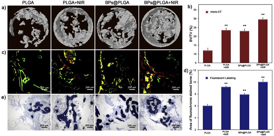 王怀雨Biomaterials：微量黑鳞造就光热响应智能生物材料，促进骨缺损再生